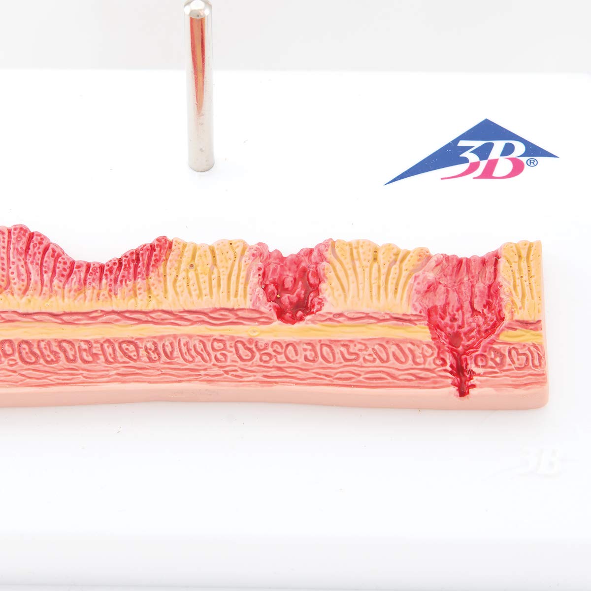 3b-scientific-magenmodell-mit-geschw-ren-humananatomie-modell-aus-pvc-smart-anat image 8