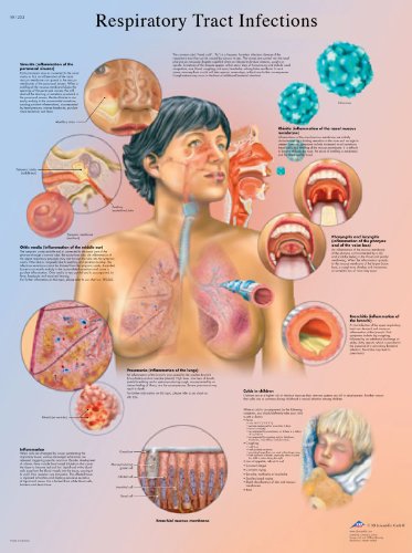 3b-scientific-lehrtafel-atemwege-infektionen-laminiert-50-8-x-66-cm image 3