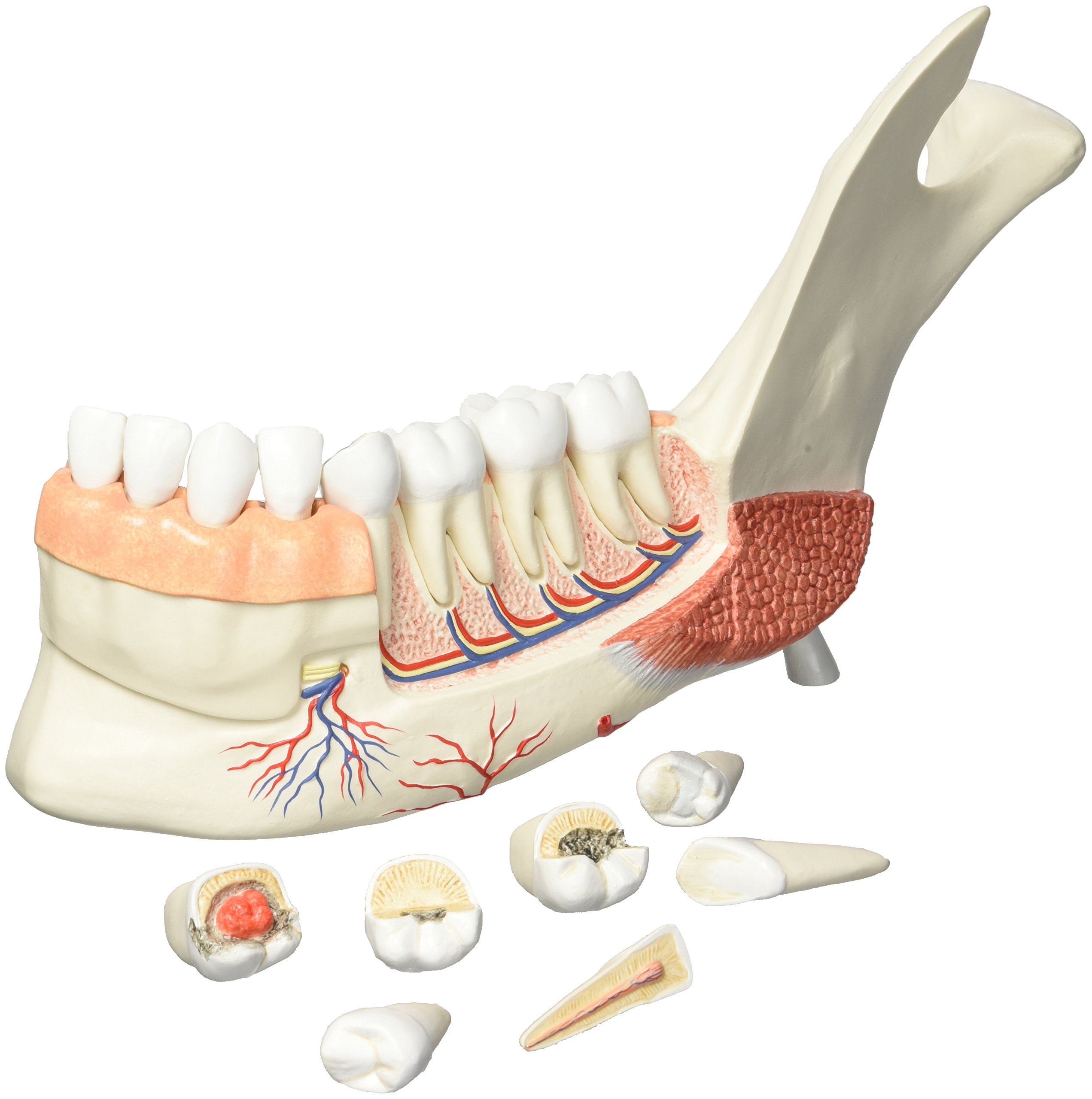 3b-scientific-unterkieferh-lfte-mit-8-kari-sen-z-hnen-19-teilig-smart-anatomy-ap image 2