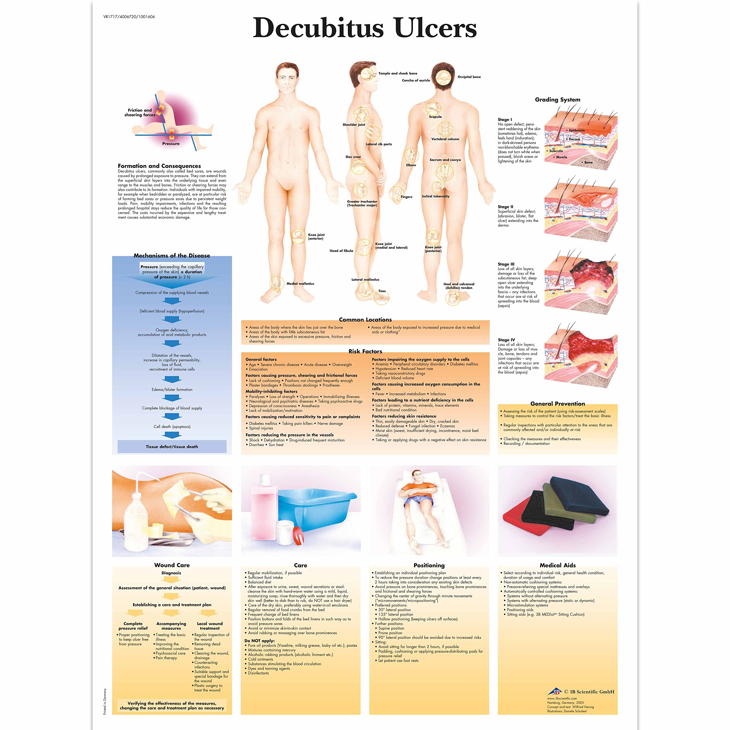 3b-scientific-lehrtafel-dekubitusgeschw-re-laminiertes-pathologie-poster-50-x-67 image 2