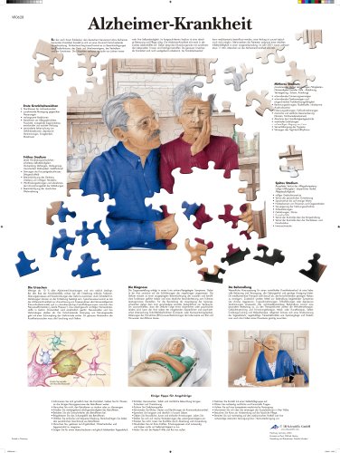 3b-scientific-lehrtafel-alzheimer-krankheit-anatomisches-poster-50x67-cm image 2