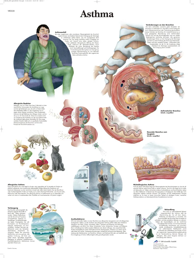 3b-scientific-lehrtafel-asthma-anatomie-poster-50-x-67-cm image 1