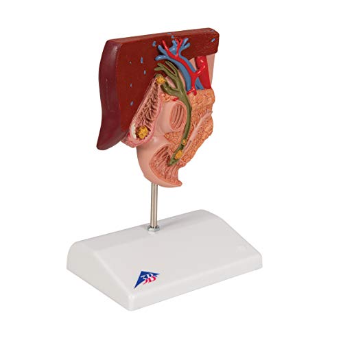 3b-scientific-gallenstein-modell-gallenblasenanatomie-mit-gallensteinbildungen-a image 7