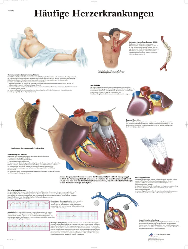 3b-scientific-lehrtafel-h-ufige-herzerkrankungen-laminiertes-poster-50-x-67-cm image 1