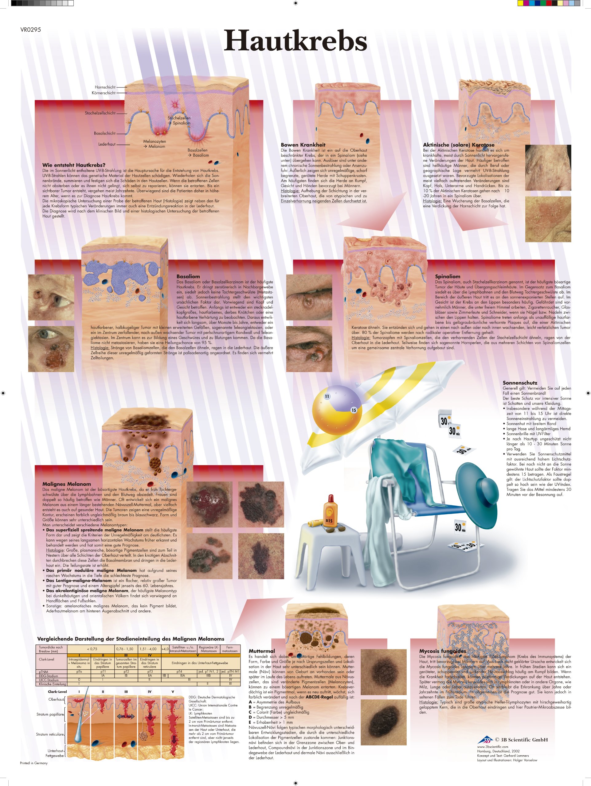 3b-scientific-lehrtafel-hautkrebs-laminiertes-anatomie-poster-50-x-67-cm image 1