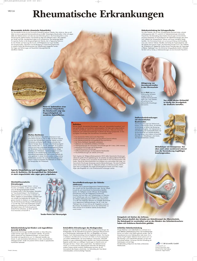 3b-scientific-lehrtafel-rheumatische-erkrankungen-anatomie-poster-50-x-67-cm image 1