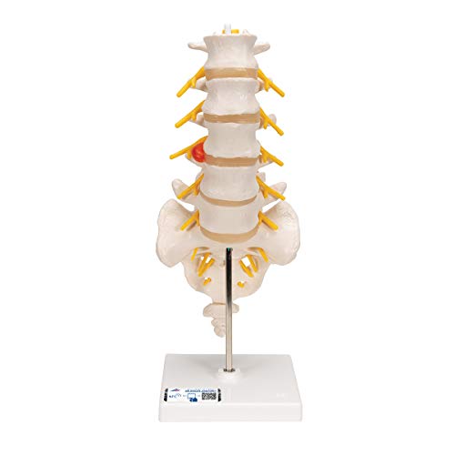 3b-scientific-lendenwirbels-ulenmodell-lebensgro-mit-bandscheibenvorfall-smart-a image 6