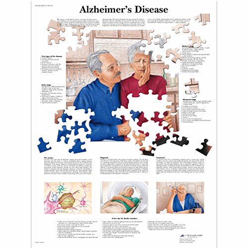 3b-scientific-alzheimer-krankheit-laminierte-anatomie-lehrtafel-50-x-67-cm image 4