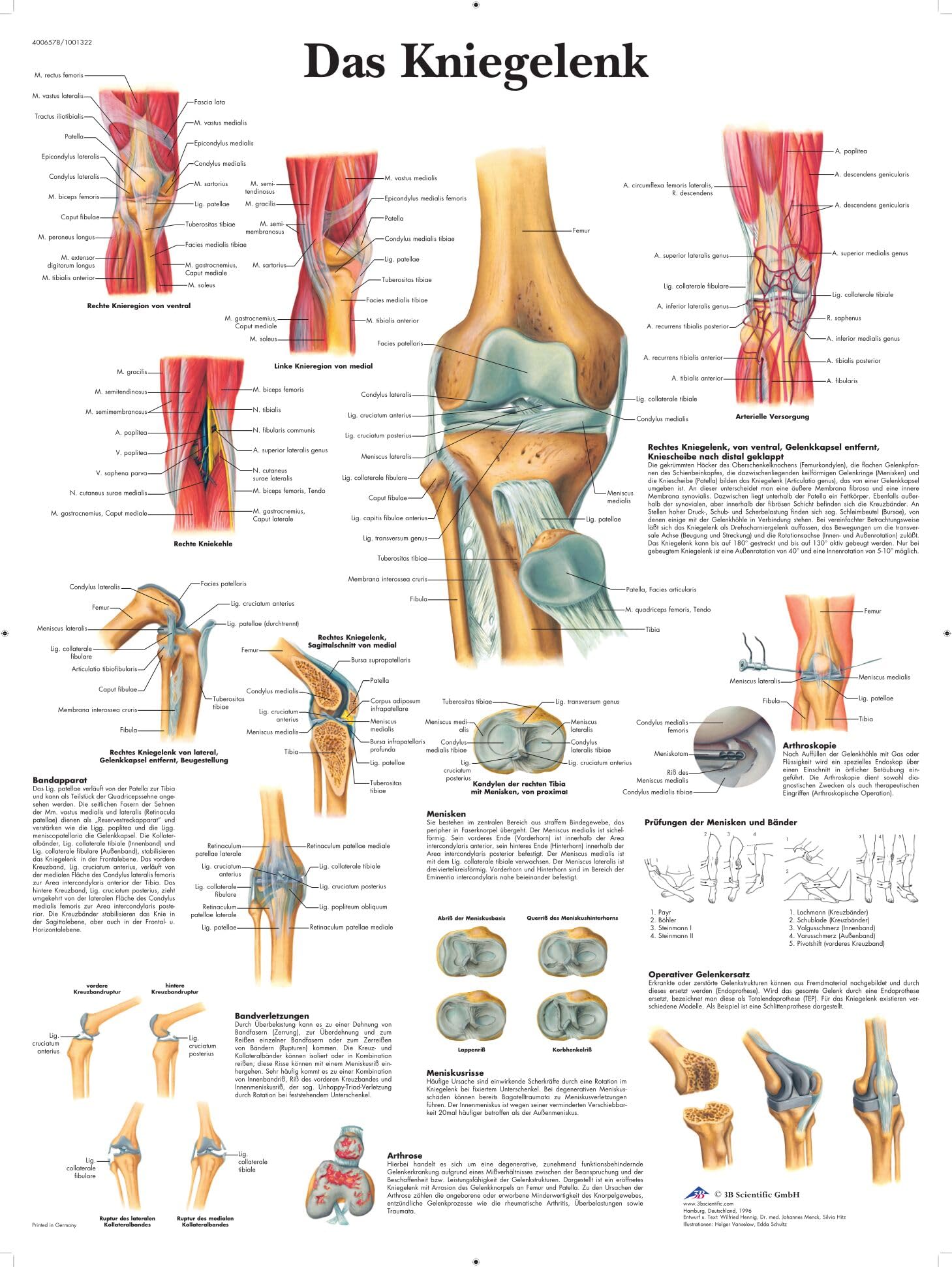 3b-scientific-laminierte-kniegelenk-tafel-anatomie-pathologie-poster-50-x-67-cm- image 1