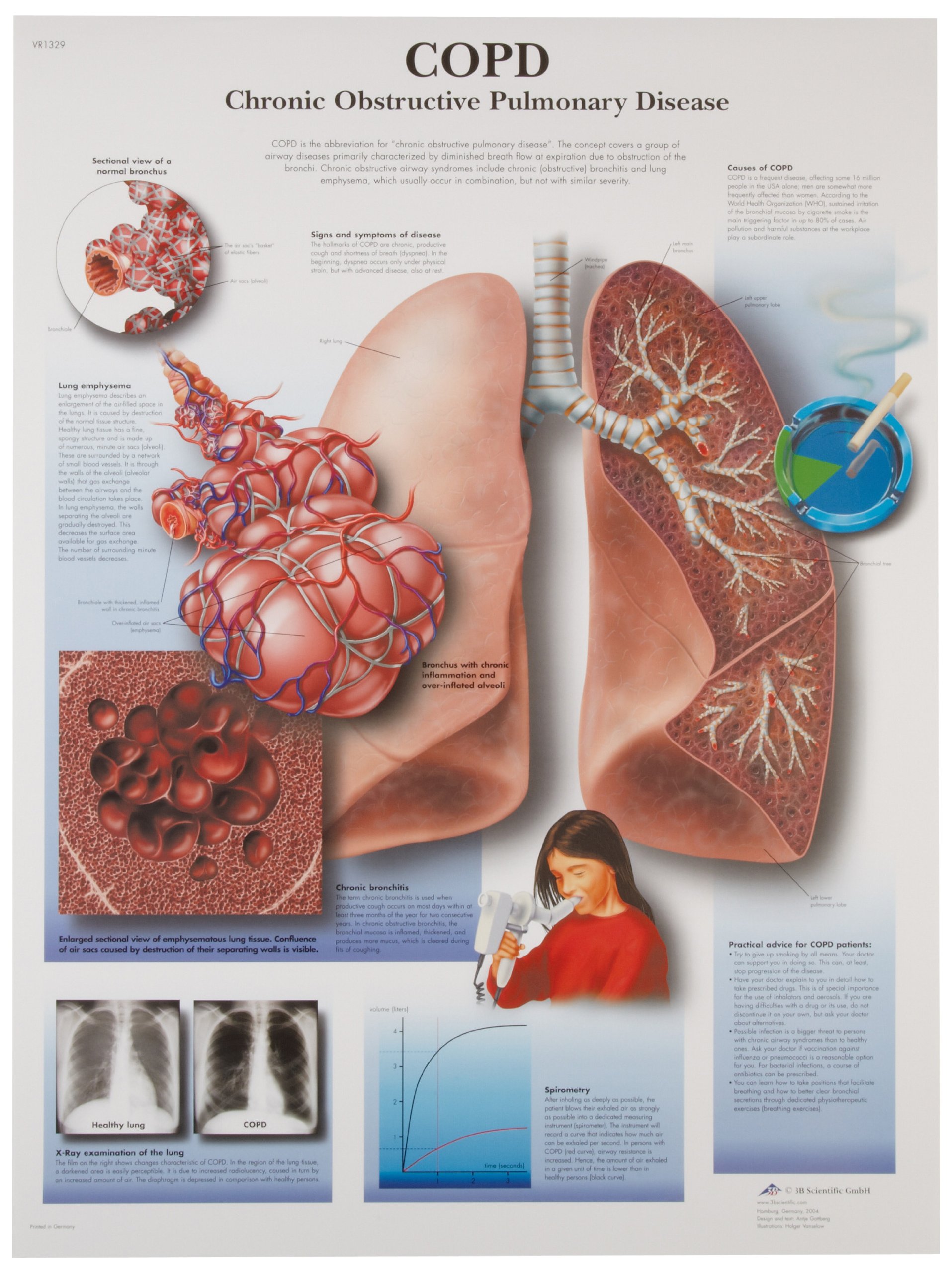 3b-scientific-copd-chronisch-obstruktive-lungenerkrankung-laminierte-lehrtafel-5 image 2