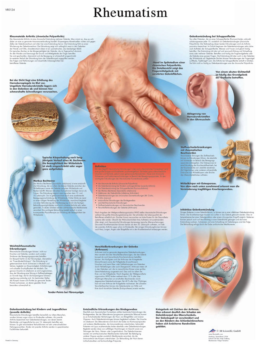 3b-scientific-lehrtafel-rheumatische-erkrankungen-laminiertes-poster-50-x-67-cm image 2