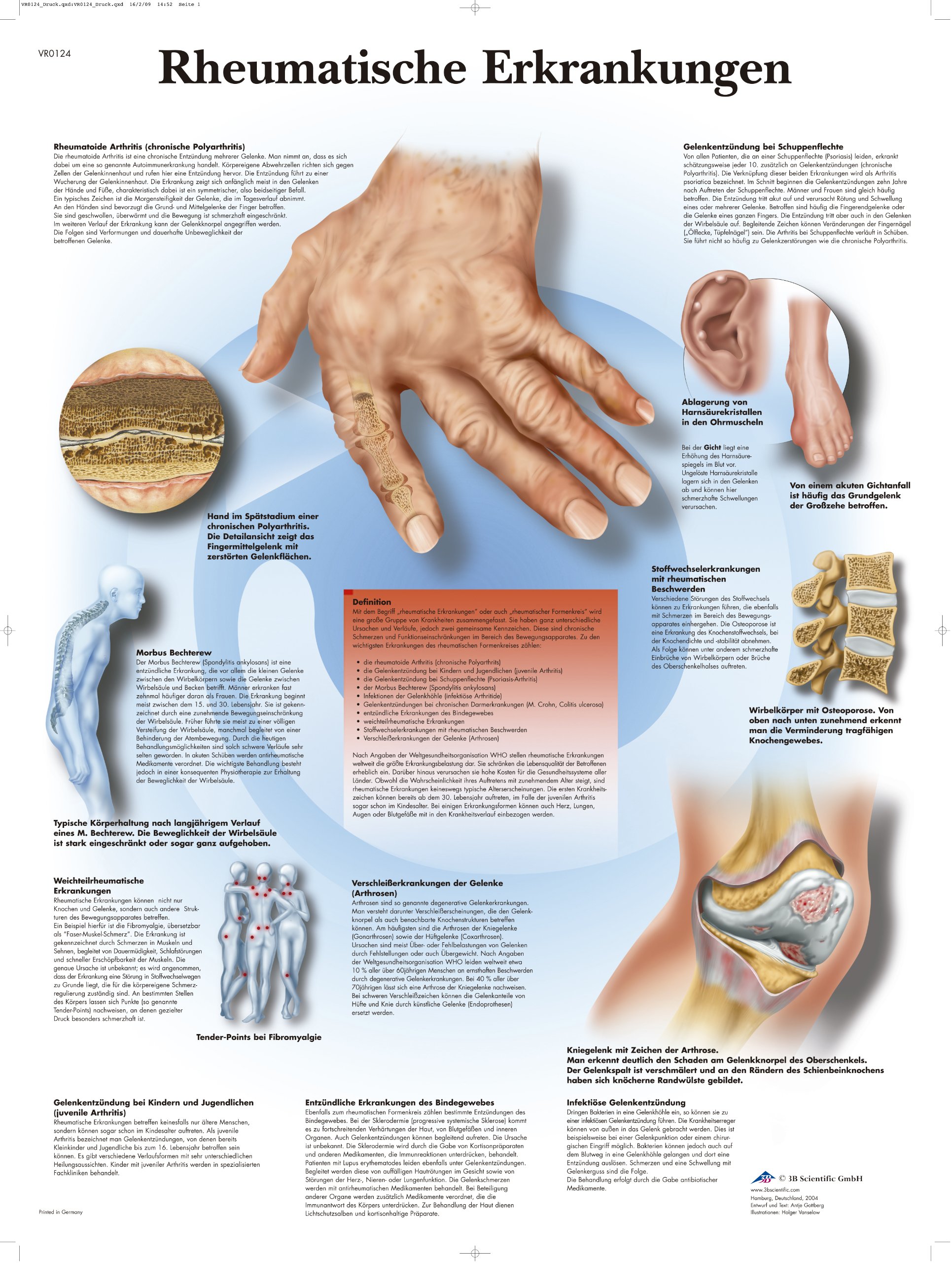 3b-scientific-lehrtafel-rheumatische-erkrankungen-anatomie-poster-50-x-67-cm image 1