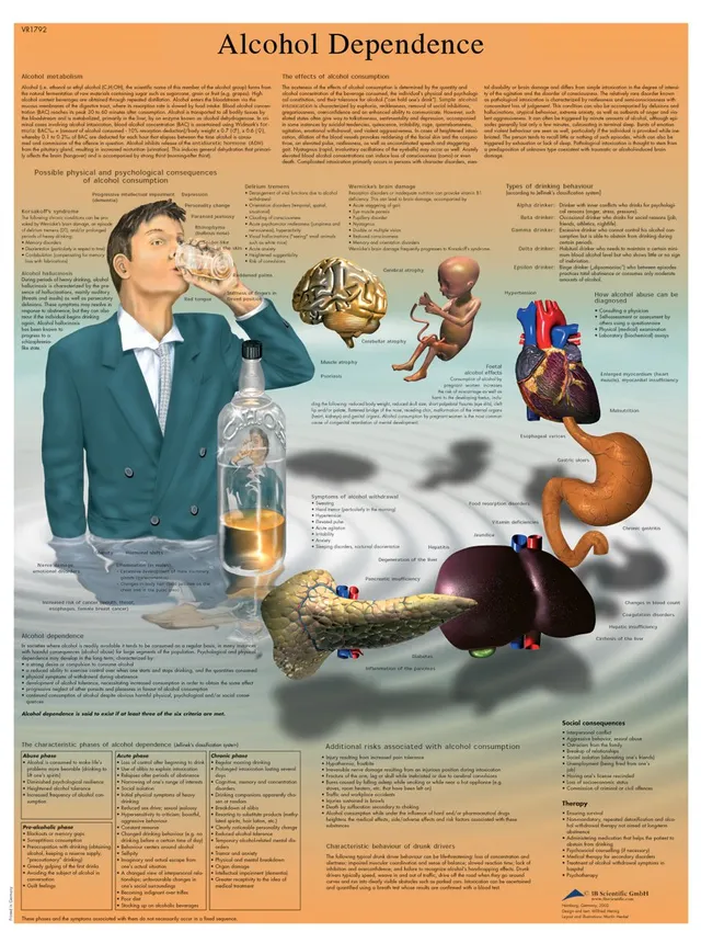 3b-scientific-lehrtafel-alkoholabh-ngigkeit-laminiertes-anatomie-poster-50-x-67- image 1