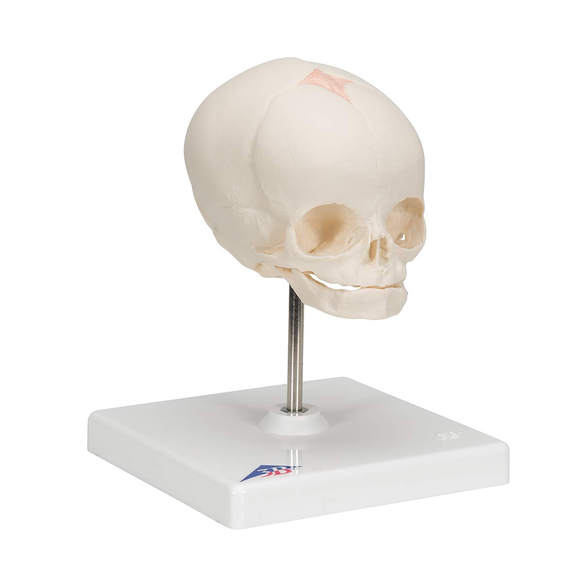 3b-scientific-f-tus-sch-del-naturabguss-30-ssw-auf-stativ image 2
