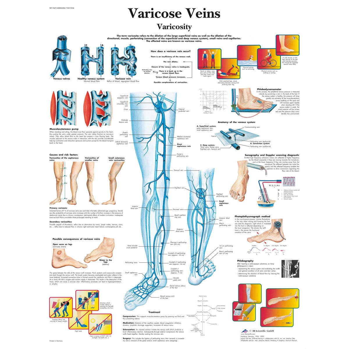 3b-scientific-lehrtafel-varicose-veins-englisch-laminiert-50-x-67-cm image 1