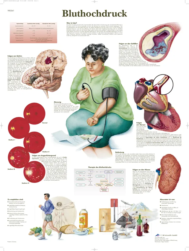 3b-scientific-lehrtafel-bluthochdruck-anatomie-poster-50x67-cm-auf-200g-papier image 1