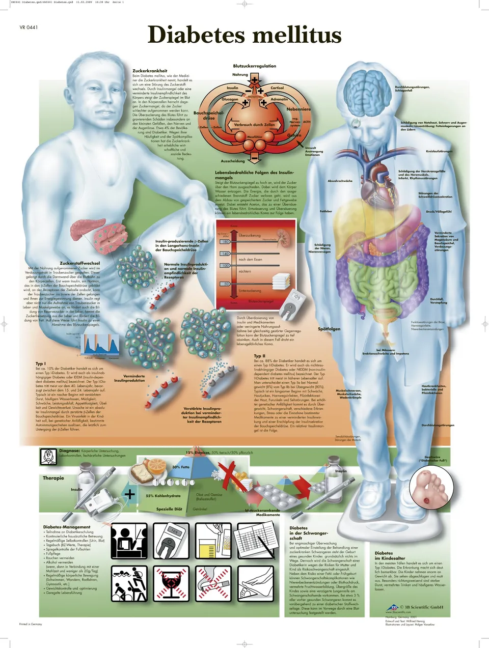 3b-scientific-lehrtafel-diabetes-mellitus-poster-50x67-cm image 1