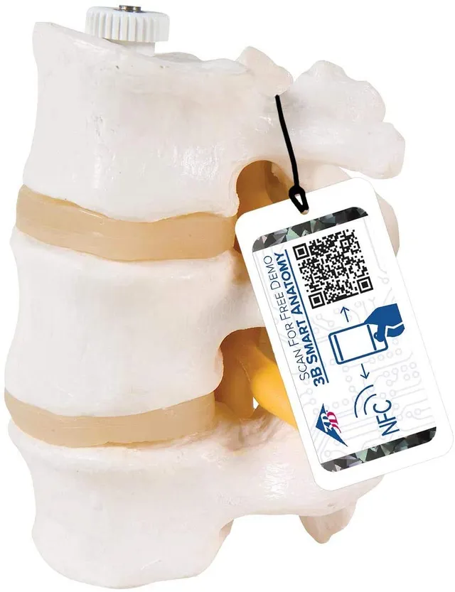 3b-scientific-a76-8-3-lendenwirbel-flexibel-montiert-mit-spinalnerven image 1
