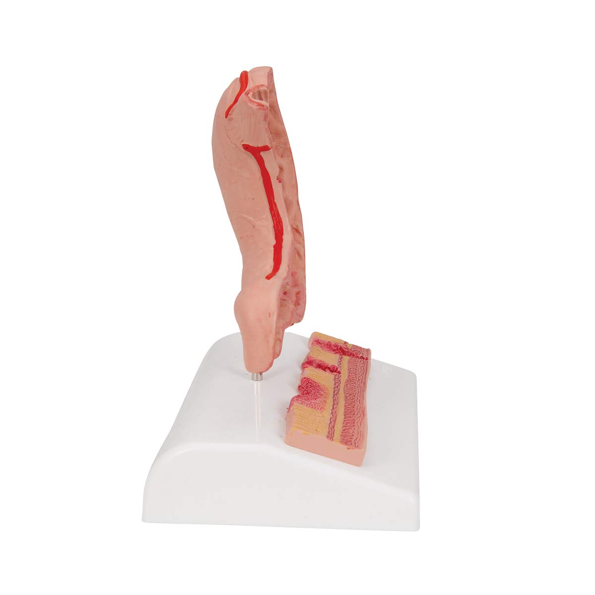 3b-scientific-magenmodell-mit-geschw-ren-humananatomie-modell-aus-pvc-smart-anat image 5