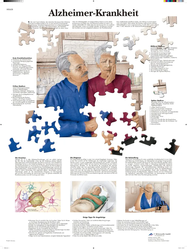 3b-scientific-lehrtafel-alzheimer-krankheit-anatomisches-poster-50x67-cm image 1