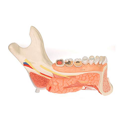3b-scientific-unterkieferh-lfte-mit-8-kari-sen-z-hnen-19-teilig-smart-anatomy-ap image 8