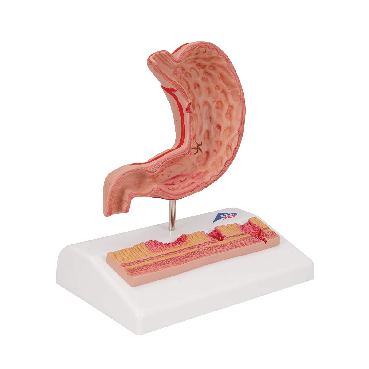 3b-scientific-magenmodell-mit-geschw-ren-humananatomie-modell-aus-pvc-smart-anat image 6