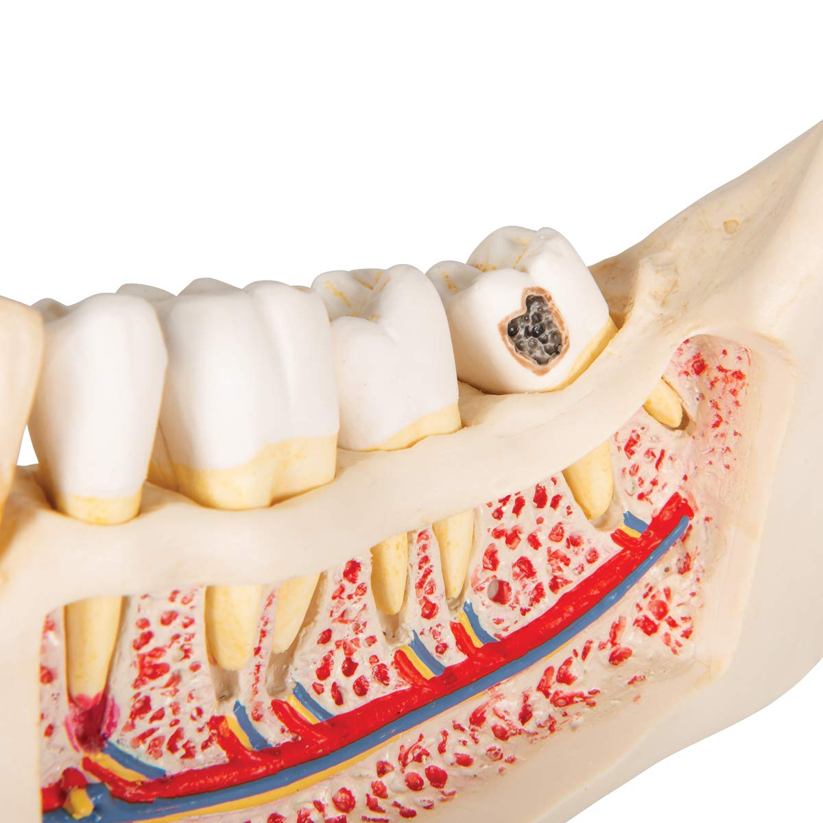 3b-scientific-zahnerkrankungsmodell-2-fach-vergr-ert-21-teilig-smart-anatomy-app image 5