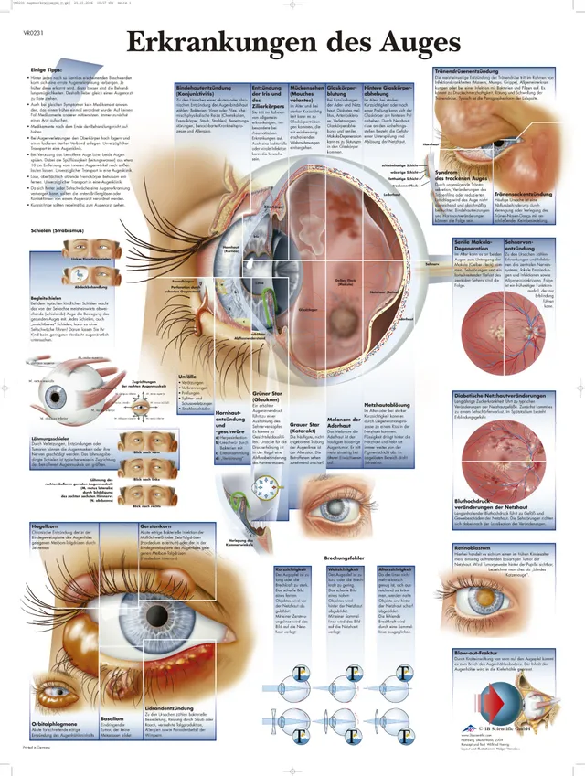 3b-scientific-lehrtafel-erkrankungen-des-auges-vr0231uu-anatomie-poster-50-x-67- image 1