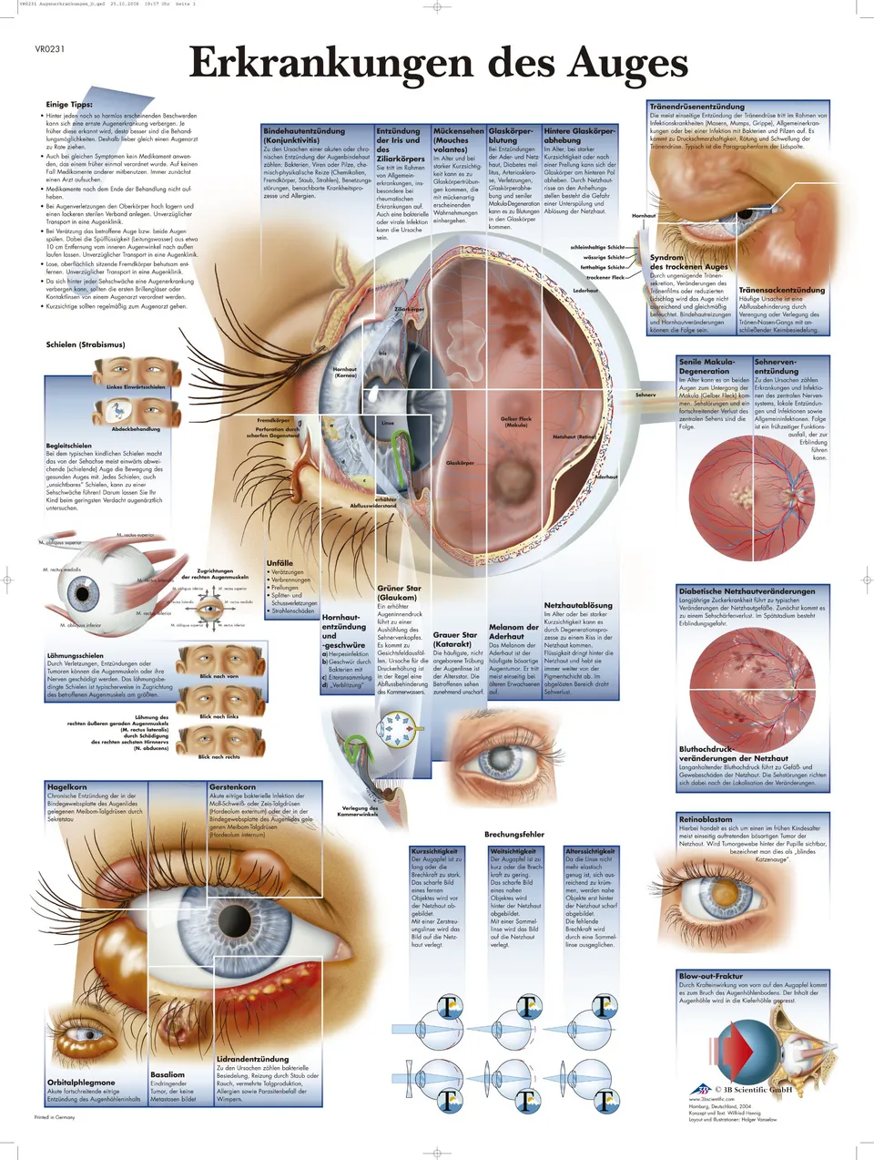 3b-scientific-lehrtafel-erkrankungen-des-auges-vr0231uu-anatomie-poster-50-x-67- image 1