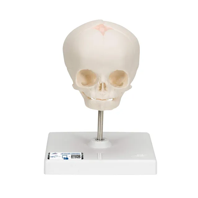 3b-scientific-f-tus-sch-del-naturabguss-30-ssw-auf-stativ image 1