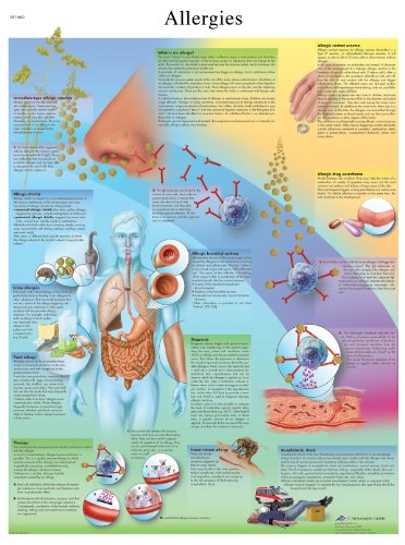 3b-scientific-lehrtafel-allergien-laminiertes-anatomie-poster-50-x-67-cm image 3