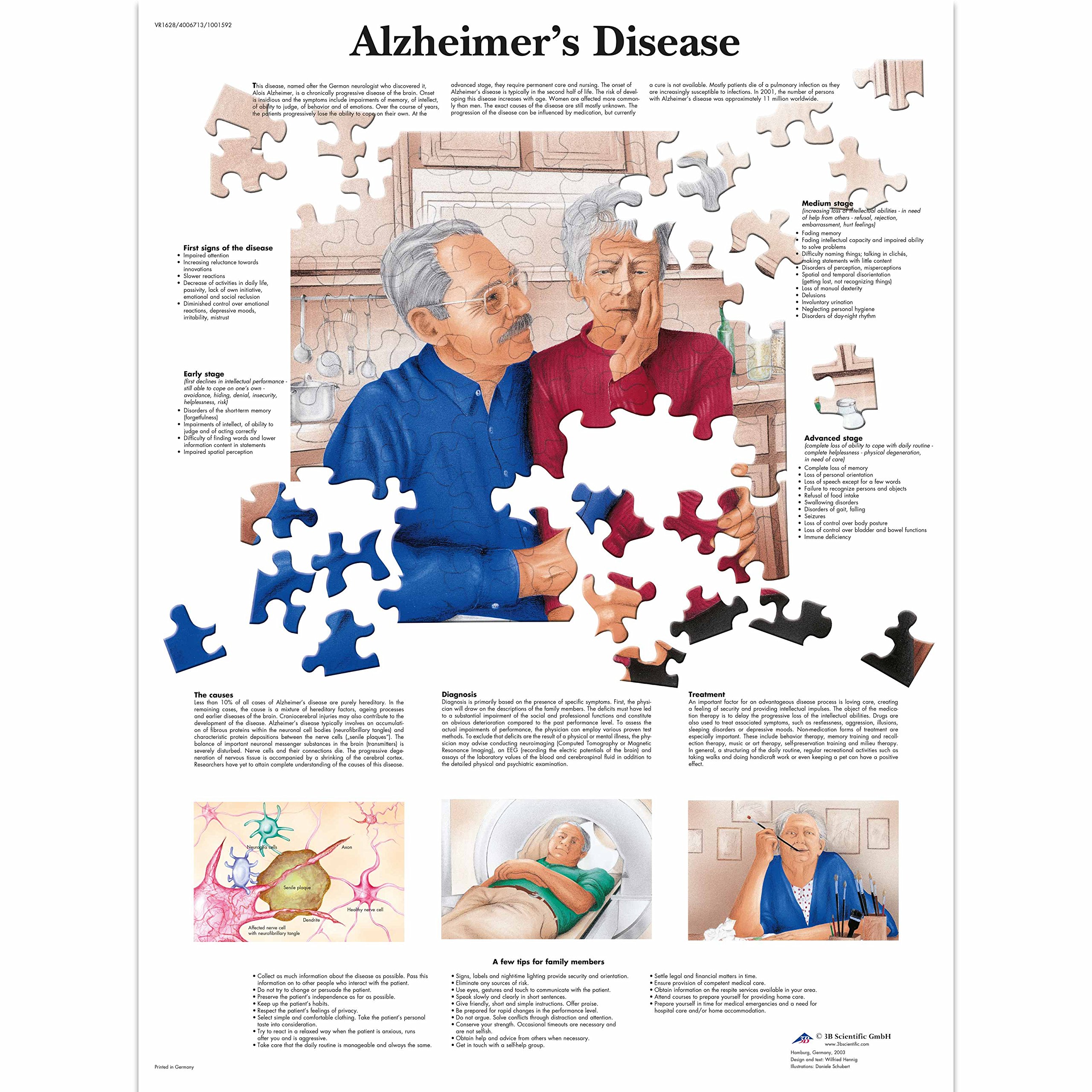 3b-scientific-alzheimer-krankheit-laminierte-anatomie-lehrtafel-50-x-67-cm image 2
