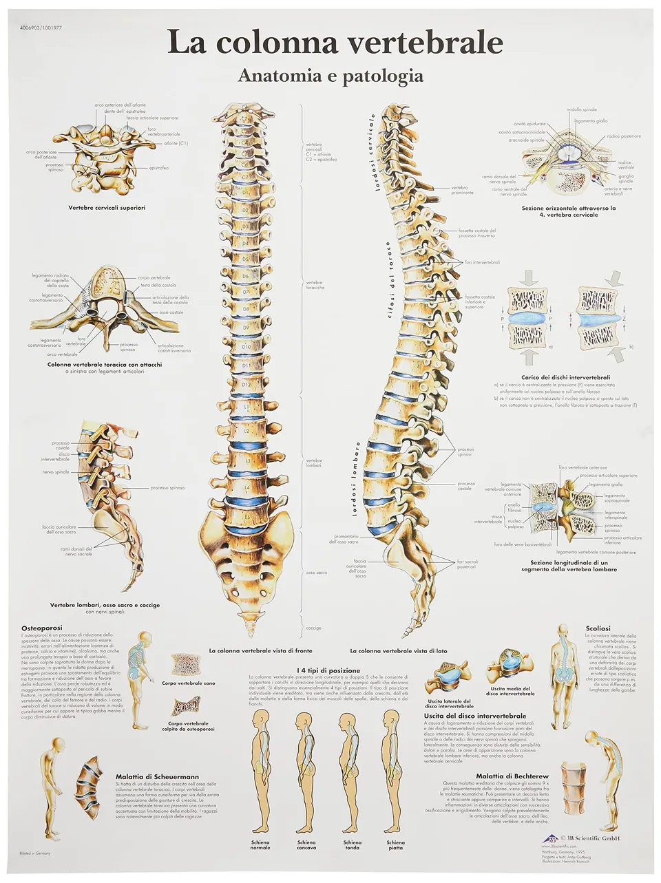 3b-scientific-wirbels-ule-und-wirbels-ulenpathologien-anatomietafel-papier image 1