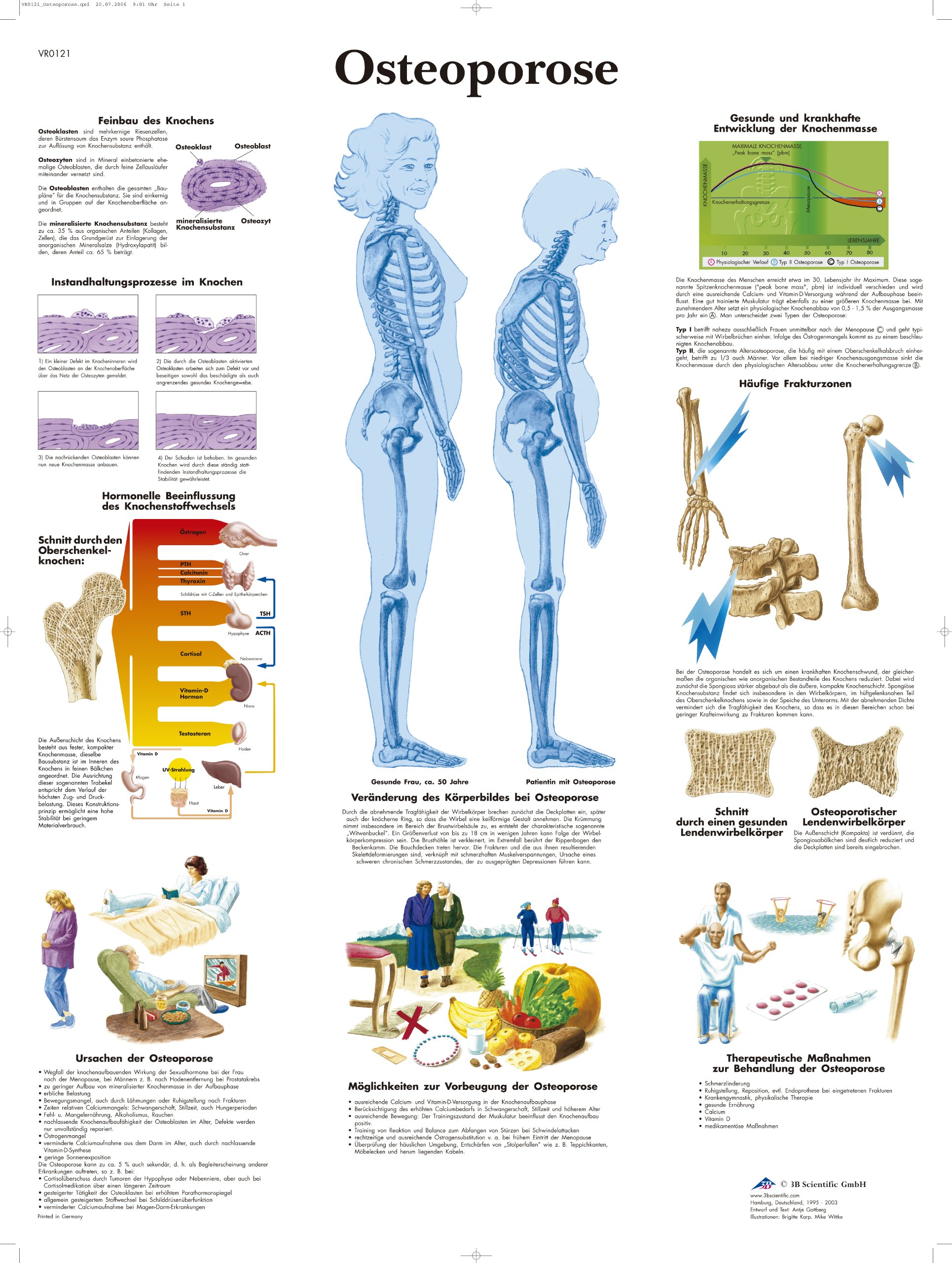 3b-scientific-lehrtafel-osteoporose-vr0121l-laminiert-50x67-cm image 1