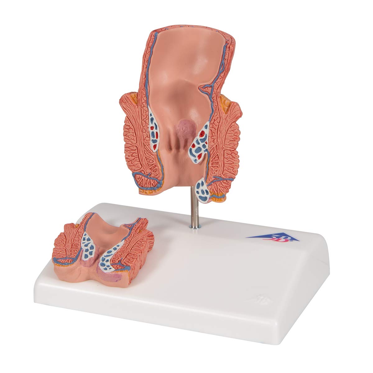 3b-scientific-h-morrhoidenmodell-enddarm-frontalschnitt-3b-smart-anatomy-app image 6