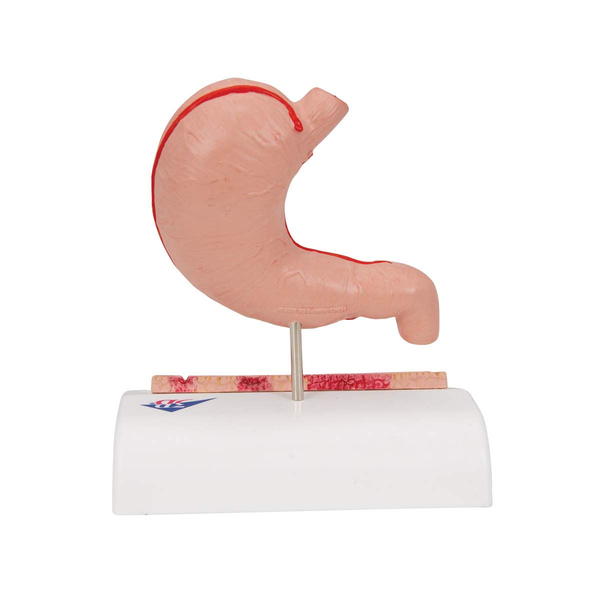 3b-scientific-magenmodell-mit-geschw-ren-humananatomie-modell-aus-pvc-smart-anat image 4