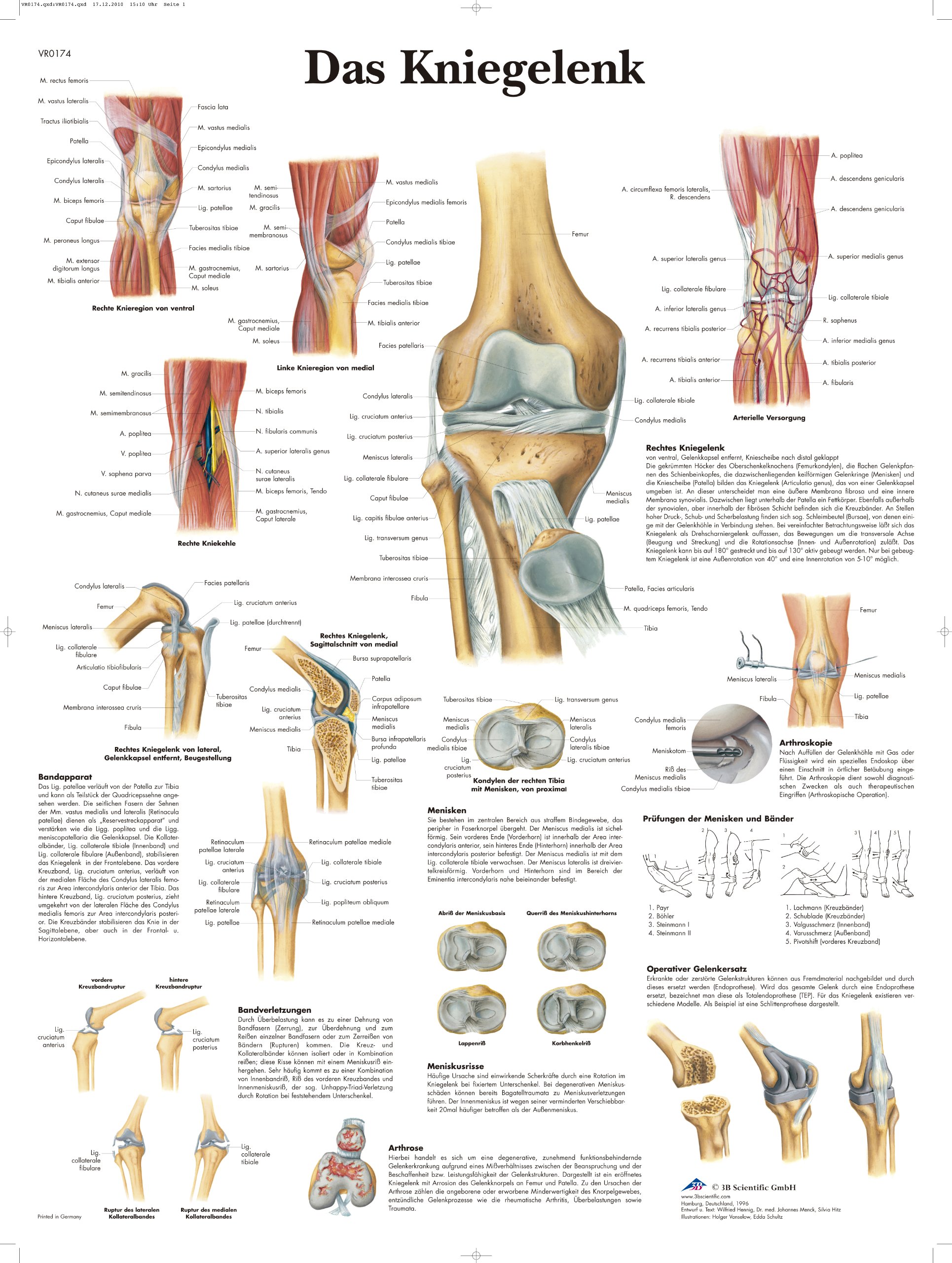 3b-scientific-laminierte-kniegelenk-tafel-anatomie-pathologie-poster-50-x-67-cm- image 2
