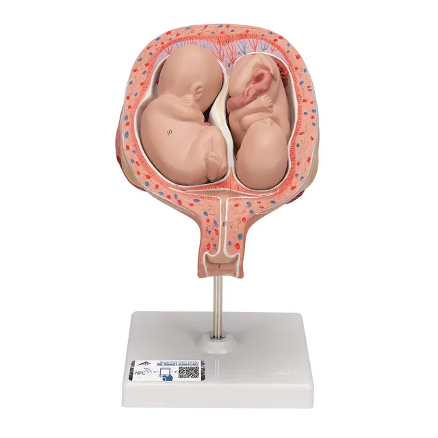 3b-scientific-zwillingsfeten-5-monat-normale-position-3b-smart-anatomy-app image 1