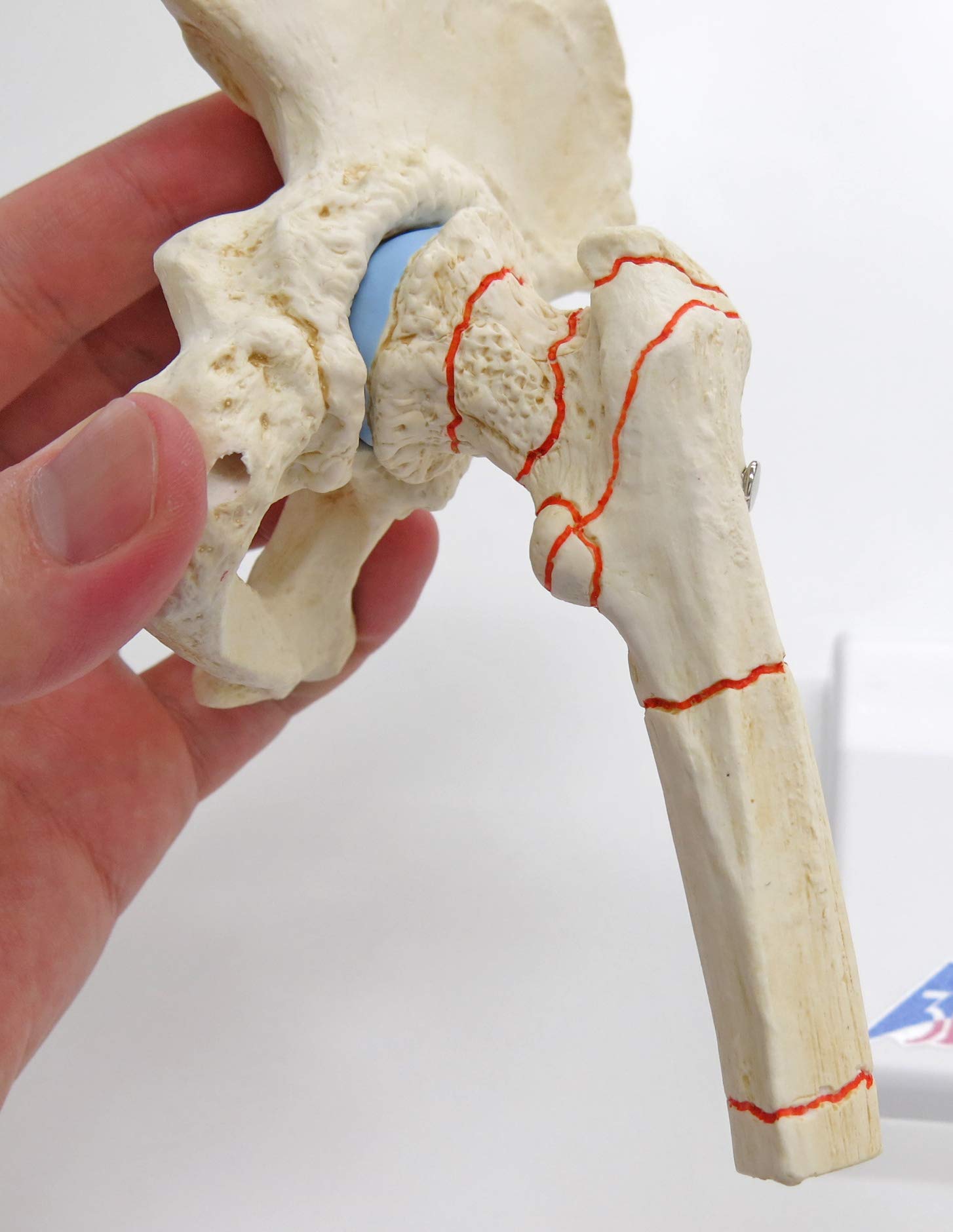 3b-scientific-h-ftgelenkmodell-mit-oberschenkelbruch-und-arthrose-pvc image 4