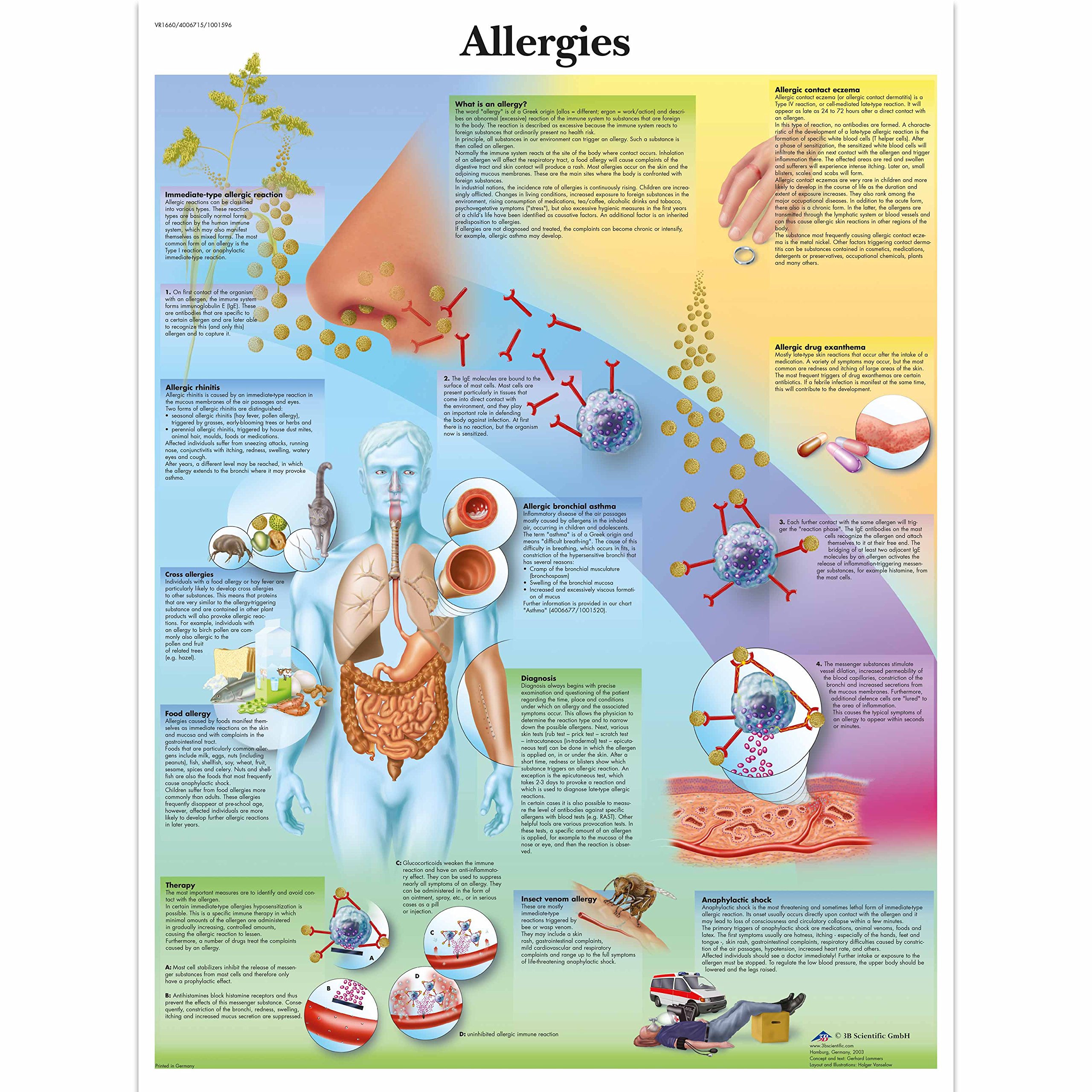 3b-scientific-lehrtafel-allergien-laminiertes-anatomie-poster-50-x-67-cm image 2