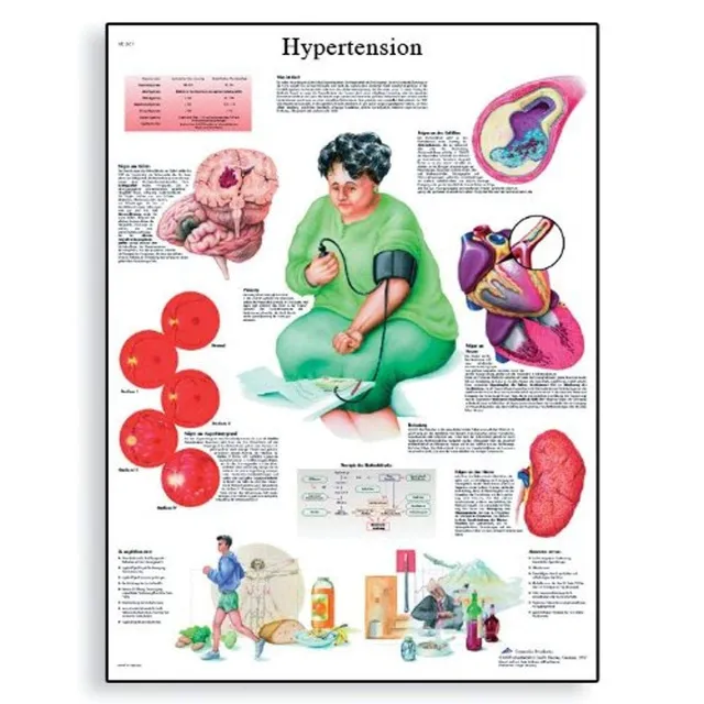 3b-scientific-hypertonie-diagramm-papier-50-x-67-cm-anatomie-lehrtafel-bluthochd image 1