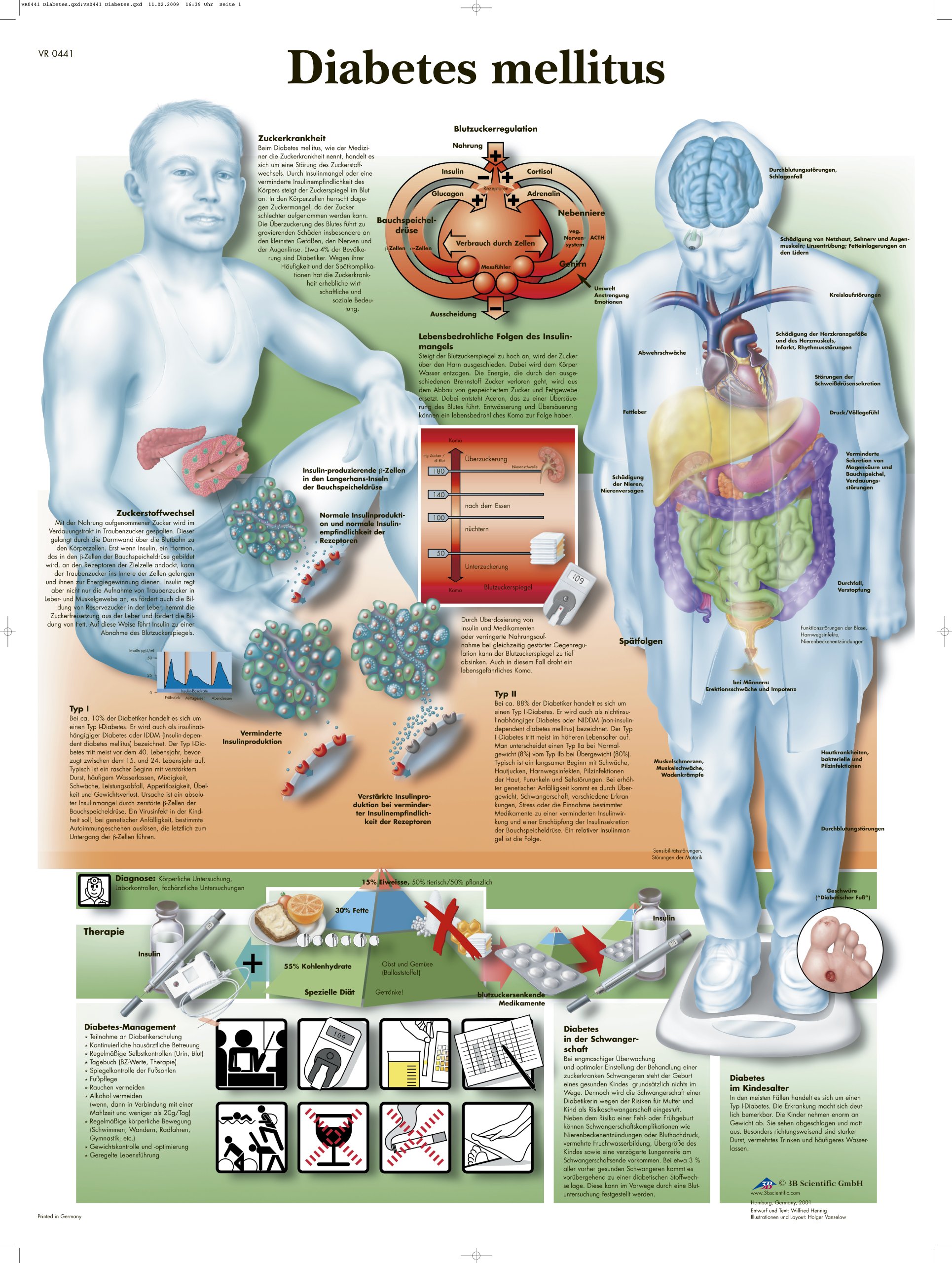3b-scientific-lehrtafel-diabetes-mellitus-poster-50x67-cm image 1