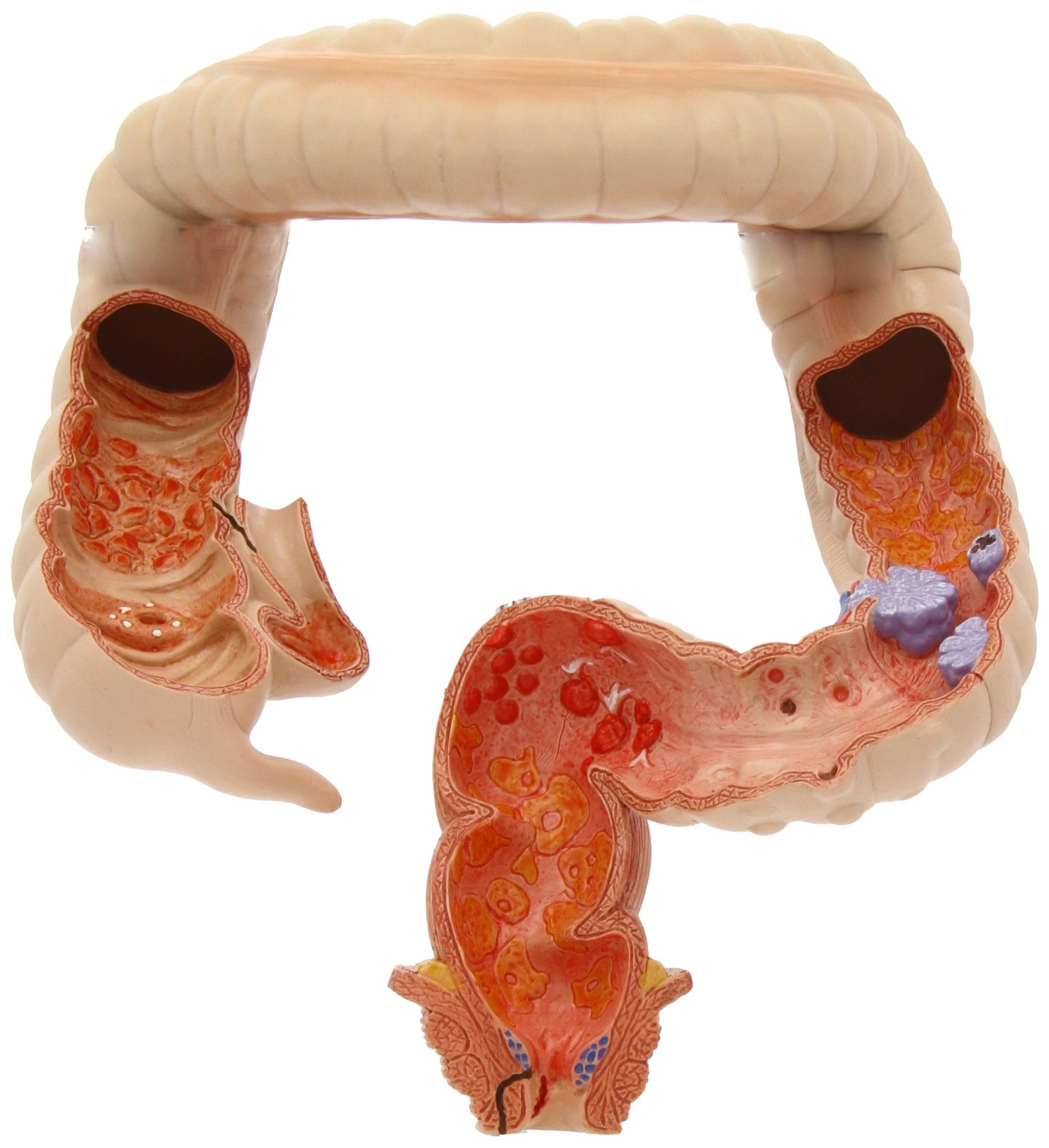 3b-scientific-dickdarm-modell-k55-anatomie-verdauung image 6