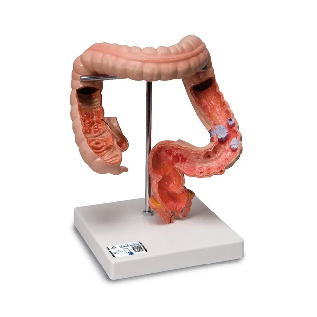 3b-scientific-dickdarm-modell-k55-anatomie-verdauung image 1