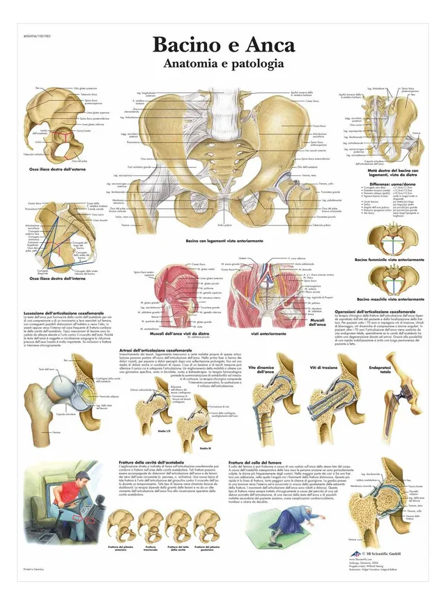 3b-scientific-vr4172l-poster-becken-und-h-fte-anatomie-und-pathologie image 1