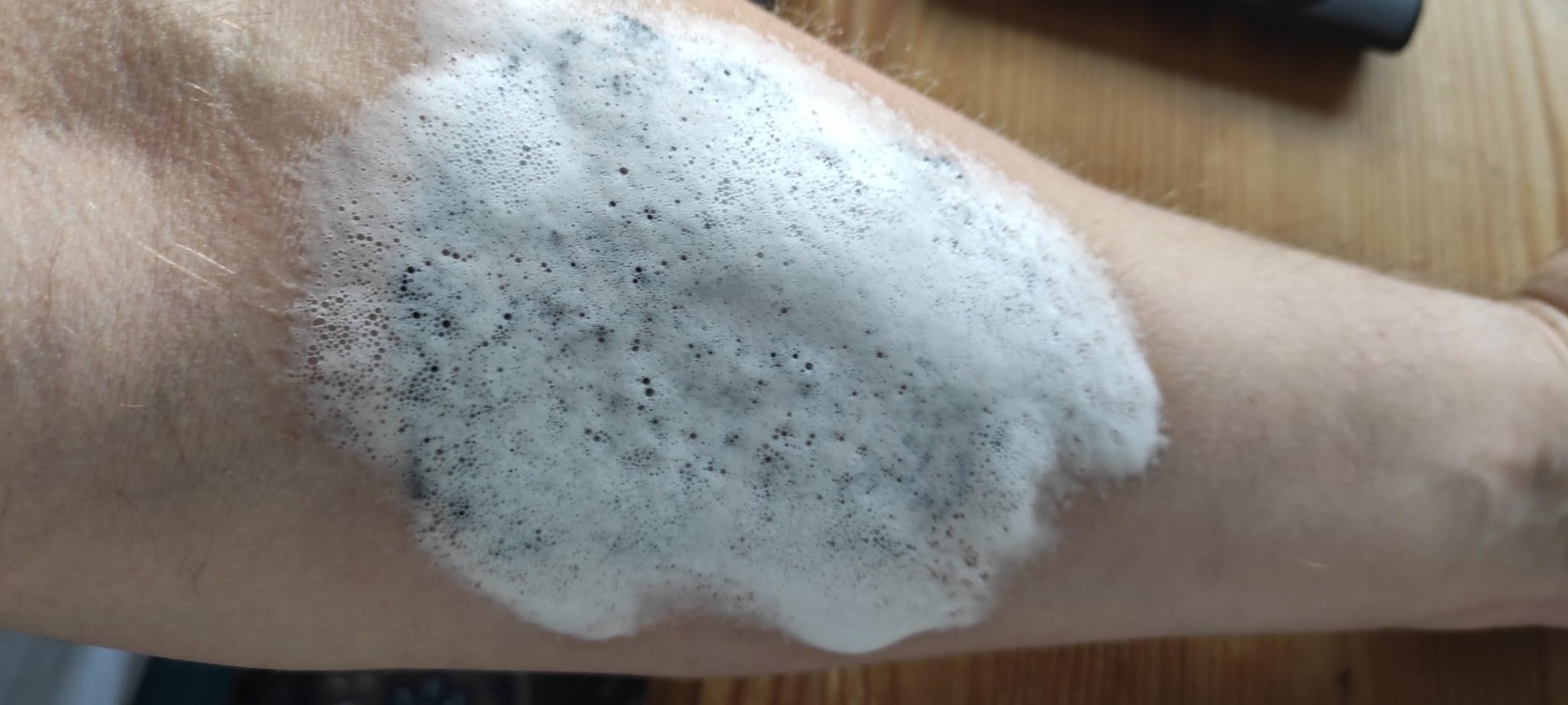 Urlaubsretter bei Sonnenbrand