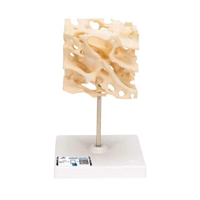 3b-scientific-knochenspongiosa-modell-100-fach-vergr-ert-3b-smart-anatomy-app image 1