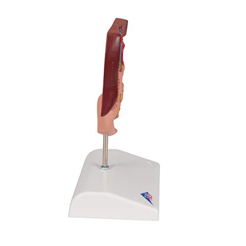 3b-scientific-gallenstein-modell-gallenblasenanatomie-mit-gallensteinbildungen-a image 8