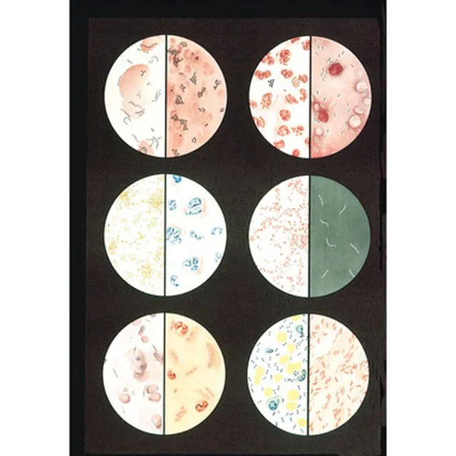 3b-scientific-bakterien-lehrtafel-84-x-200-cm-mit-holzst-bung image 1
