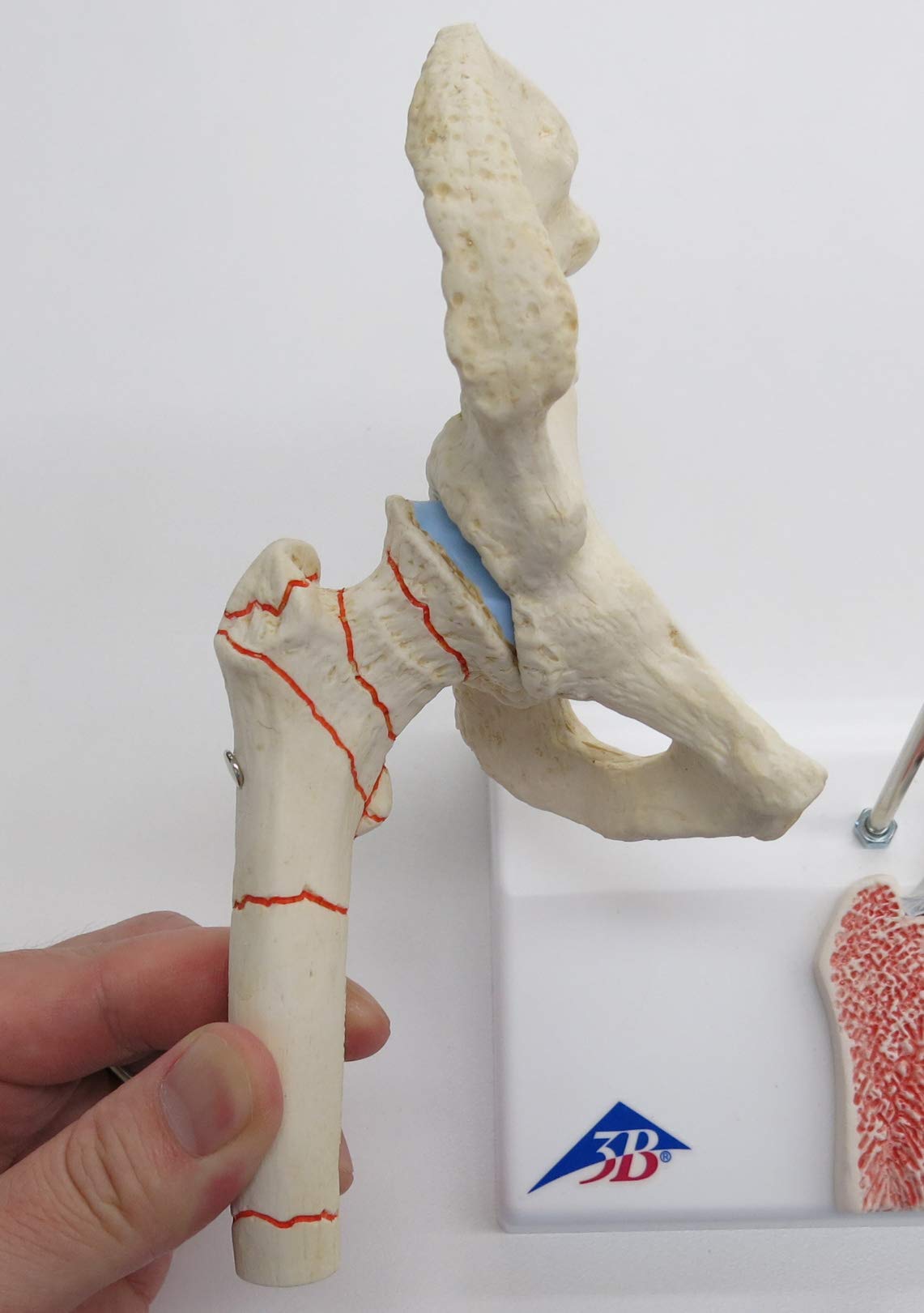 3b-scientific-h-ftgelenkmodell-mit-oberschenkelbruch-und-arthrose-pvc image 5